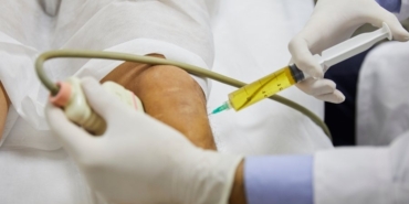 kök hücre tedavisi (2)