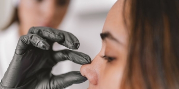 Doğal Burun Estetiği