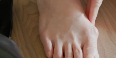 Halluks Rigidus Yorum (2)